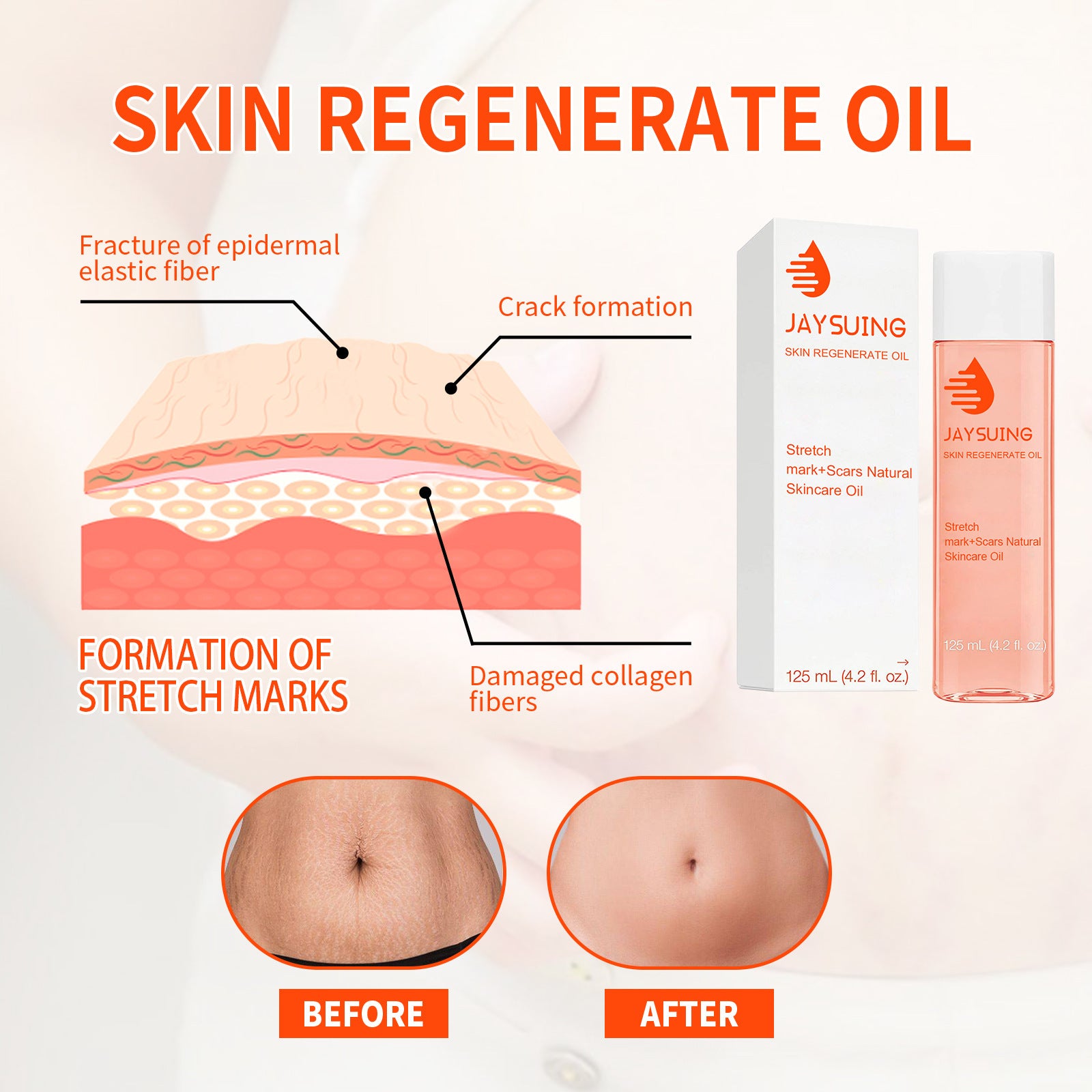 Scar Recovery Oil Fade Abdomen Firming